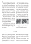 Научная статья на тему 'К вопросу об изменении аденогипофиза при гипотермии'