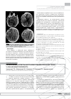 Научная статья на тему 'Кардиальные аспекты дисплазии соединительной ткани у лиц молодого возраста'