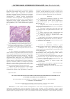 Научная статья на тему 'Кислородзависимая цитотоксичность нейтрофилов периферической крови после полихимиотерапии при раке яичников'