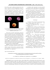 Научная статья на тему 'Клиническая оценка эффективности применения фотодинамотерапии в предупреждении вторичного кариеса'