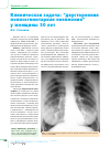 Научная статья на тему 'Клиническая задача: "двусторонняя полисегментарная пневмония" у женщины 50 лет'