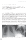 Научная статья на тему 'Клинический случай гриппа, осложнившегося тяжелой пневмониейи острой дыхательной недостаточностью'