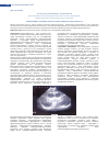 Научная статья на тему 'Клинический случай медуллобластомы у ребенка грудного возраста'