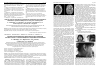 Научная статья на тему 'Клиническое наблюдение поздней диагностики поражения головного мозга у 35-летней женщины с синдромом Штурге-Вебера'