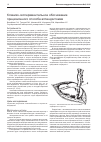 Научная статья на тему 'Клинико-экспериментальное обоснование прецизионного способа аппендэктомии'