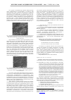 Научная статья на тему 'Клинико-лабораторная характеристика обтурации корневых каналов с использованием силера RoekoSeal'