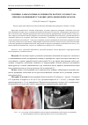 Научная статья на тему 'Клинико-лабораторные особенности костного гомеостаза при неосложненной установке дентальных имплантатов'