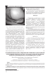 Научная статья на тему 'Комбинированная ингаляционно-внутривенная анестезия при оперативных вмешательствах у больных злокачественными новообразованиями желудочно-кишечного тракта'