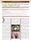 Научная статья на тему 'Комплексное этапное лечение порока полового члена у мальчиков с эписпадией и экстрофией мочевого пузыря'