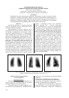 Научная статья на тему 'Компьютерная обработка сцинтиграфических изображений легких'