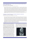 Научная статья на тему 'Лапароскопическая цистогастростомия при гигантской псевдокисте поджелудочной железы: клинический случай'