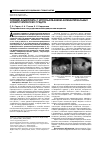 Научная статья на тему 'Лечение альвеолита с использованием антибактериальных и гемостатических средств'