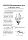 Научная статья на тему 'Лечение больных с повреждениями костей запястья методом чрескостного остеосинтеза'