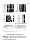 Научная статья на тему 'Лечение деформаций нижних конечностей с использованием стержневого чрескостного остеосинтеза'