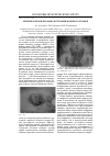 Научная статья на тему 'Лечение и реабилитация экстрофии мочевого пузыря'