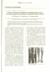 Научная статья на тему 'Лечение обширного дефекта большеберцовой кости в условиях выраженных рубцовых изменений мягких тканей'