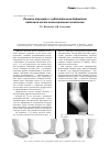 Научная статья на тему 'Лечение пациента с субтотальным дефектом пяточной кости огнестрельной этиологии'