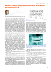 Научная статья на тему 'Линейные размеры между продольными осями опорных зубов мостовидного протеза'