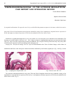 Научная статья на тему 'Lymphangiohemangioma of the anterior mediastinum: case report and literature review'