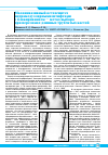 Научная статья на тему 'Малоинвазивный остеосинтез интрамедуллярными штифтами с блокированием - метод выбора при переломах длинных трубчатых костей'