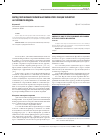 Научная статья на тему 'Метод перенесения полной анатомии кросс-секции челюстей на гипсовую модель'