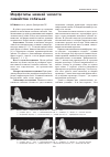 Научная статья на тему 'Морфотипы нижней челюсти семейства собачьих'