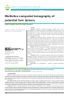 Научная статья на тему 'Multislice computed tomography of potential liver donors'
