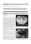 Научная статья на тему 'Наблюдение врожденной гипоплазии желчного пузыря в сочетании с гемангиомой печени'