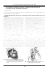 Научная статья на тему 'Нарушение функции печени, поджелудочной железы и почек после операции Фонтена'
