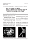 Научная статья на тему 'Непосредственные результаты эндоваскулярного протезирования аневризм инфраренального отдела аорты у больных с тяжелой сопутствующей патологией'