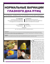 Научная статья на тему 'Нормальные вариации глазного дна птиц'