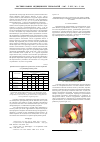 Научная статья на тему 'Новые технологии коррекции кифо-сколиотической деформации позвоночника'
