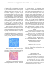 Научная статья на тему 'Новый метод трансдуоденальной папиллосфинктеротомии'