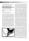 Научная статья на тему 'Новый вид шунтирования у детей с внепеченочной формой портальной гипертензии'