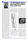 Научная статья на тему 'О чем говорят нанофоссилии палеогеновых морских кокколитофорид из поверхностных пленок на уральских алмазах'