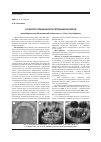 Научная статья на тему 'О распространенности ретенции моляров'