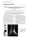 Научная статья на тему 'Одноэтапное двухстороннее устранение рекурвационных деформаций коленных суставов'