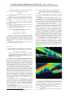 Научная статья на тему 'Оптическая когерентная томография угла передней камеры в оценке состояния переднего отрезка глаза'