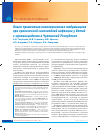 Научная статья на тему 'Опыт применения ингаляционного тобрамицина при хронической синегнойной инфекции у детей с муковисцидозом в Чувашской Республике'