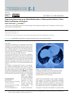 Научная статья на тему 'Organising Pneumonia as an Initial Manifestation of Rheumatoid Arthritis: A Case Report and Review of Literature'