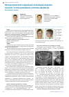 Научная статья на тему 'Ортодонтическая коррекция положения верхних клыков с использованием системы Деймона'