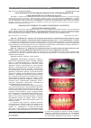 Научная статья на тему 'Ортодонтическая помощь в комплексном лечении пациентов с выраженной патологией пародонта'