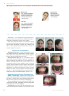 Научная статья на тему 'Ортодонтическое лечение мезиальной окклюзии'