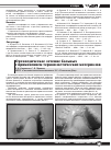 Научная статья на тему 'Ортопедическое лечение больных с применением термопластических материалов'