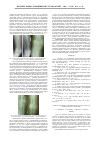 Научная статья на тему 'Основные закономерности в течении репаративных процессов в области энтеро-энтероанастомоза после устранения различных видов острой кишечной непроходимости'
