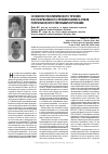 Научная статья на тему 'Особенности клинического течения и консервативного лечения кариеса зубов, покрытых искусственными коронками'