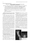 Научная статья на тему 'Особенности микротопографии внутримозговых опухолей краниоспинальной локализации'