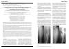 Научная статья на тему 'Особенности остеогенеза при лечении диафизарных переломов бедренной кости в зависимости от тяжести травмы (экспериментальное исследование)'