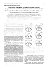 Научная статья на тему 'Особенности топографии и микрохирургической анатомии петрокливальных менингиом суб-супратенториальной локализации'
