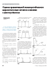 Научная статья на тему 'Оценка сравнительной помехоустойчивости широкополосных сигналов в каналах с многолучёвостью'